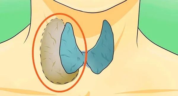 ��״�ٰ����������20�������⵽�׳������