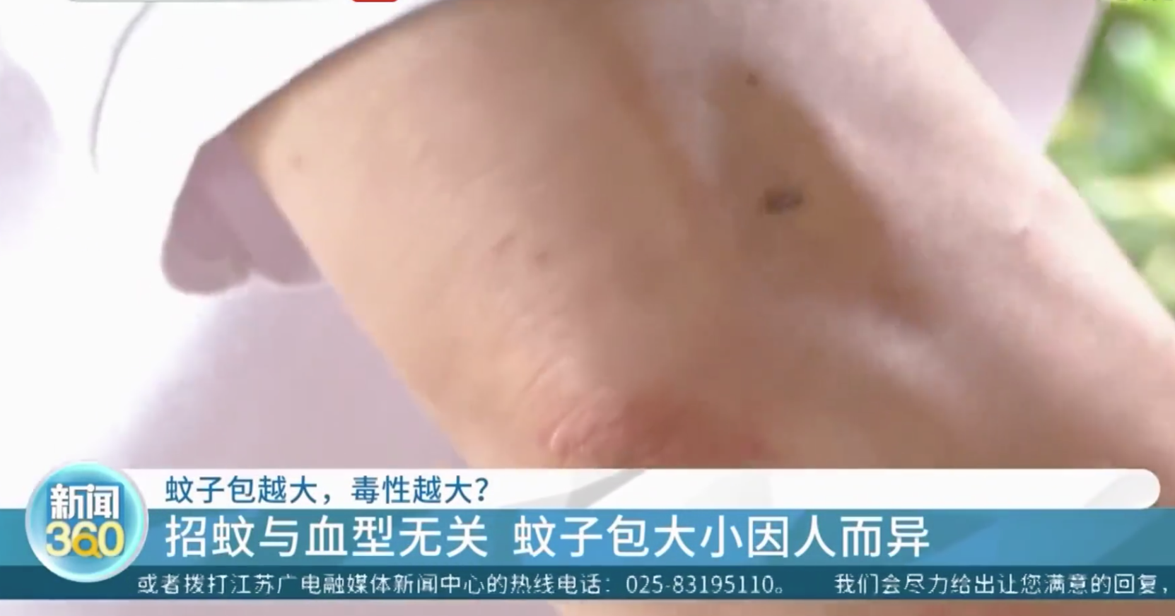 熱搜！蚊子包越大毒性越大、蚊子愛叮O型血？專家：沒有科學依據！蚊子其實愛叮這類人……