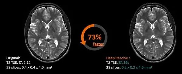 现代全新电动轿车IONIQ 6正式发布；亚马逊云科技加速布局汽车行业 | 美通企业日报