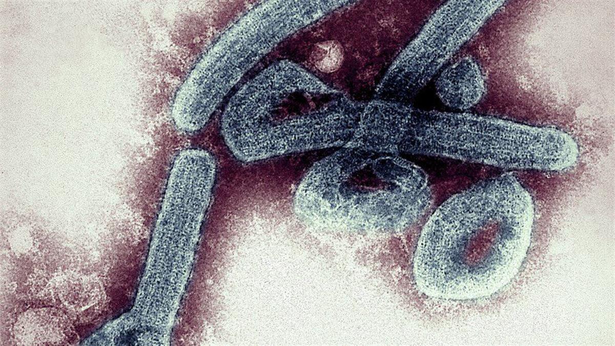 马堡病毒图片