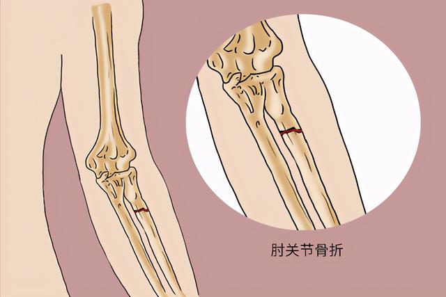 掰手腕的技巧，主要靠哪块肌肉发力