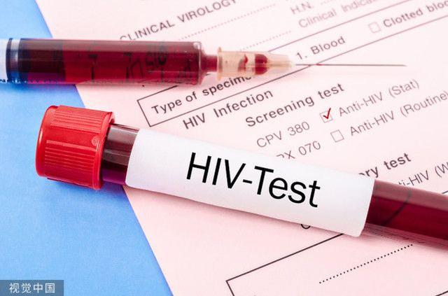 艾滋病检测费用，做个HIV检查要多少费用（24岁小伙确诊艾滋病）